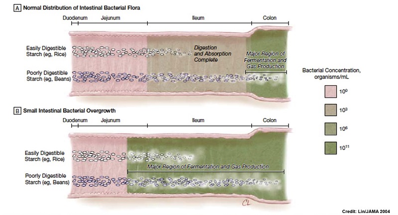 microbio